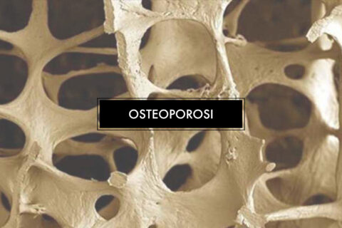 Osteoporosi alimentazione naturale